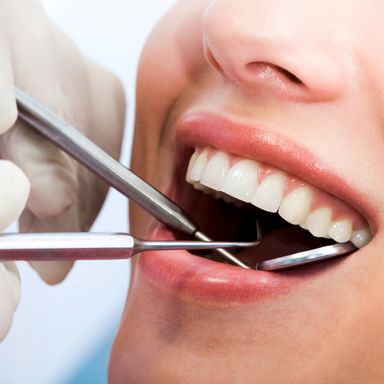 Zahnarztbehandlung für Ästhetische Füllungen in Garbsen